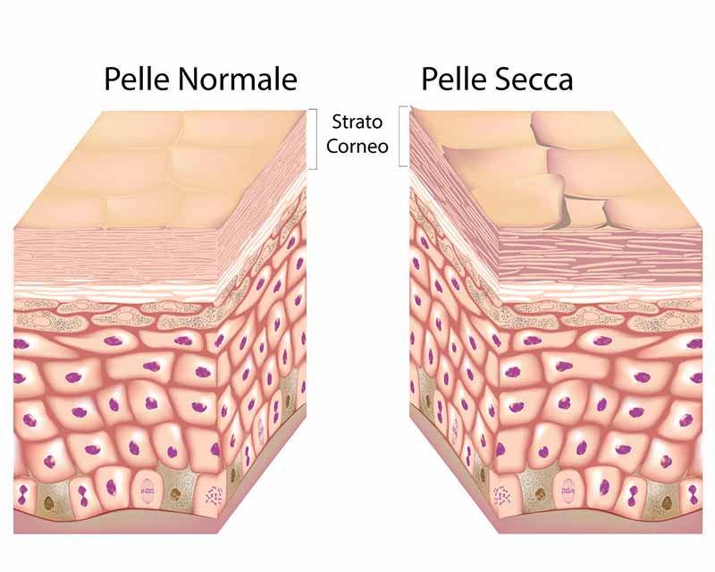 illustrazione-pelle-secca.jpg